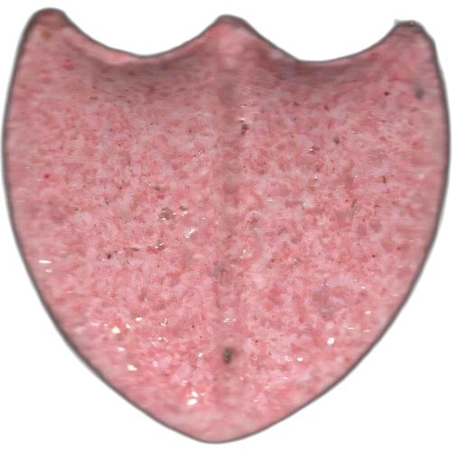Χάπι Dom Perignon — 2