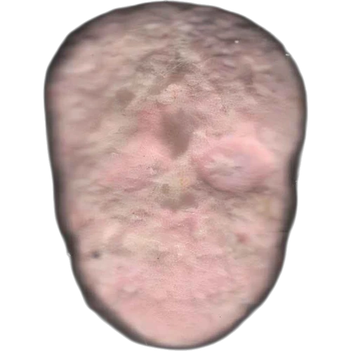 Piolla Skull
