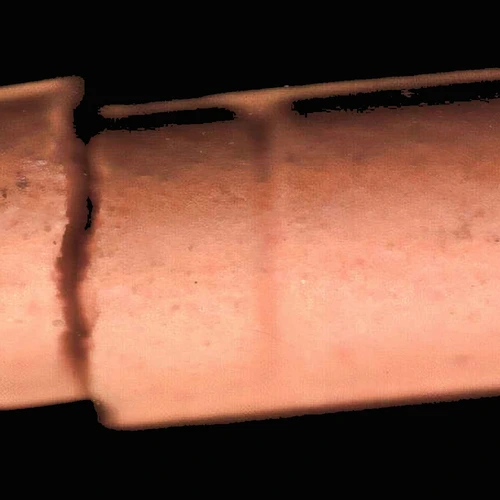 2-MMC hapı