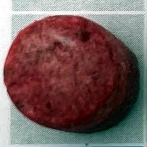 Round Pill tabletta — Unidentified cathinone; Ketamine — New Zealand