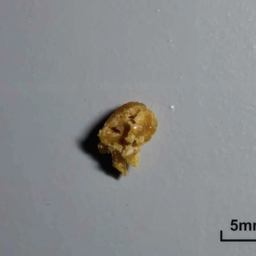 Heroin (27%); 6-MAM; Unknown-pil