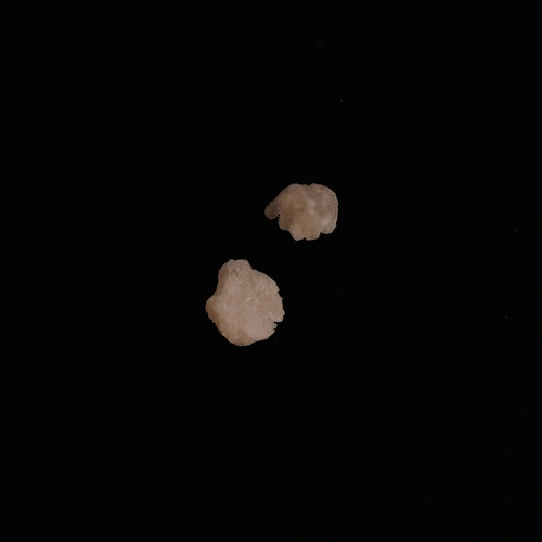 MDMA (88%) — Berlin, Německo