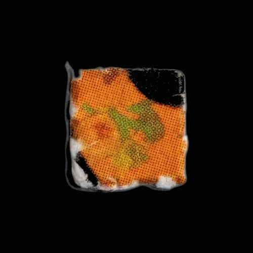 LSD (63µg); iso-LSD (43µg) — Finistère (29), France