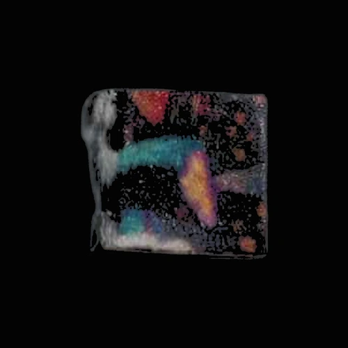 LSD (113µg); iso-LSD (15µg) — Marseille, Fransa