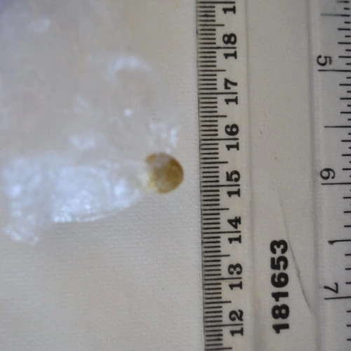 Super Mario pill — CBD; CBN; THC; CBG — Hertsmere; St Albans; Three Rivers; Watford (WD25), England