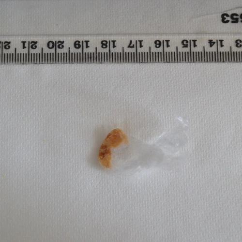 Cocaine — East Lothian; Scottish Borders (TD11), Ühendkuningriik