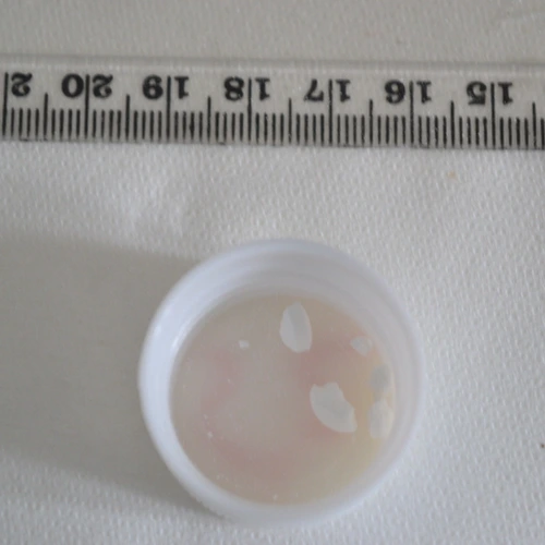 Bensedin pill — Diazepam — G6, United Kingdom