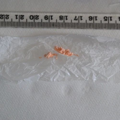 Pfizer Ativan Lorazepam pill — Lorazepam — Hackney; Islington; Tower Hamlets (E8), England