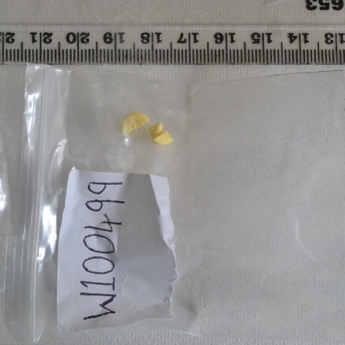 حبّة Diazapam — Diazepam — Bolton; Chorley (BL6), England