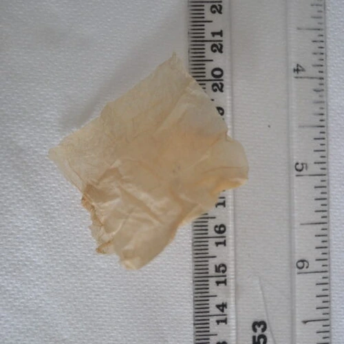 Acetylcodeine; Heroin; 6-MAM; Noscapine; Papaverine — Birmingham (B9), England