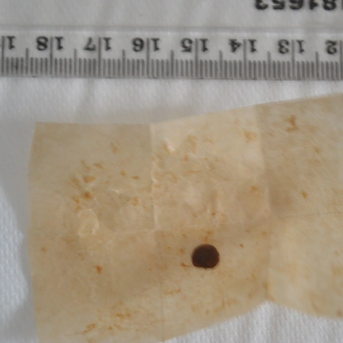 Morphine; Noscapine; Thebaine — Shropshire; South Staffordshire; Stafford; Telford and Wrekin (TF10), England