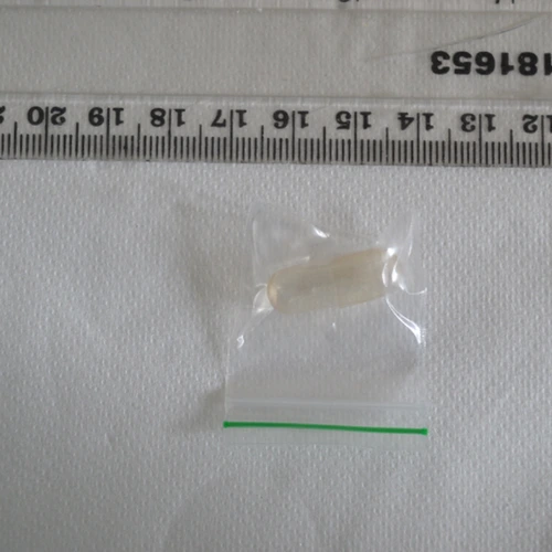 Ketamine — Bristol (BS56), England