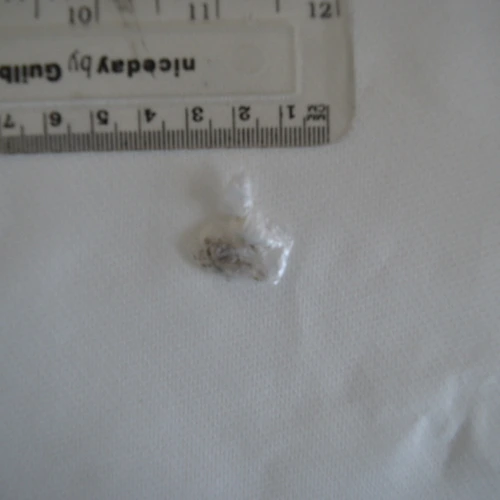 Tableta Iran Choc Chip Heroin — Heroin; 6-MAM; Noscapine; Thebacon; Dextromethorphan; Paracetamol — Redcar and Cleveland (TS11), England