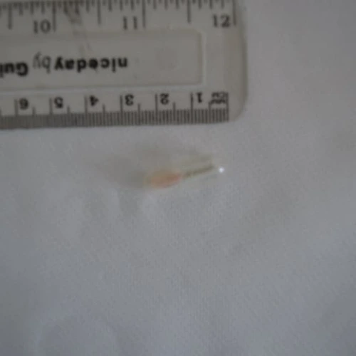 Galenika Rivotril tabletta — Unable to Identify (Insufficient sample for repeat analysis) — Hackney; Tower Hamlets (E9), England