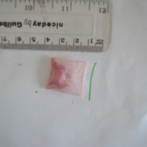 Pillola Ecstacy — MDMA — Southampton (SO15), England