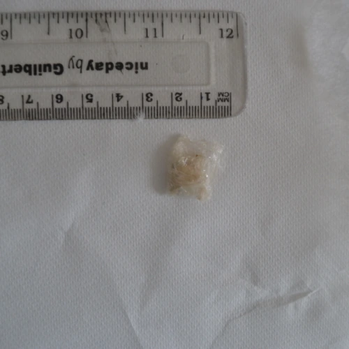 Cocaine; Benzoylecgonine; Norcocaine; Paracetamol; Tropacocaine — Vale of Glamorgan (CF63), Wales