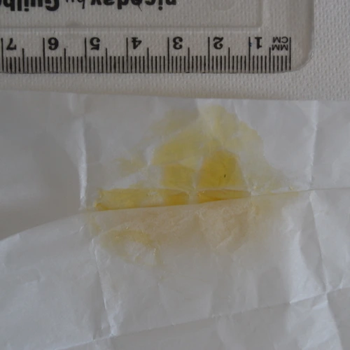 CBD; CBG; CBN; THC — East Suffolk; Great Yarmouth; South Norfolk (NR31), England