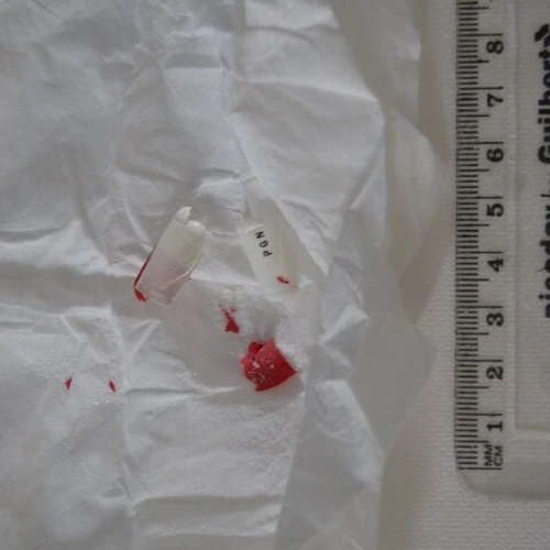Таблетка Pregablin — Pregabalin — Blaenau Gwent; Caerphilly (NP22), Wales