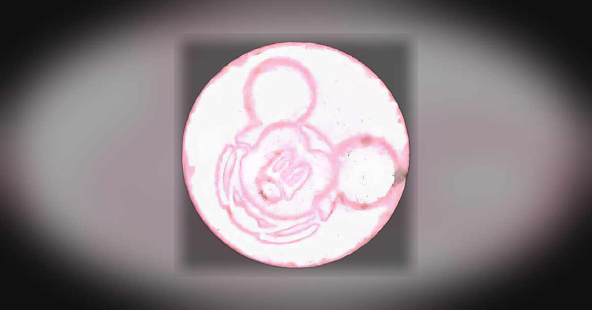 Mickey Mouse
