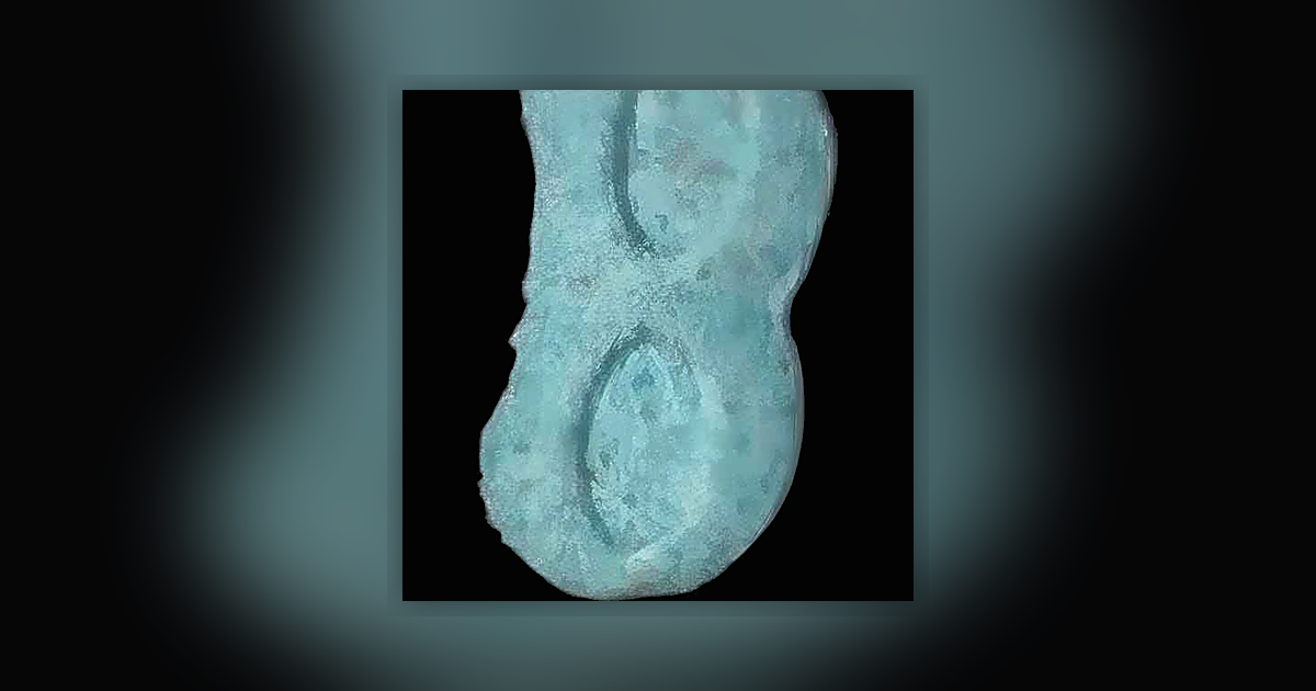 MDMA (97mg)