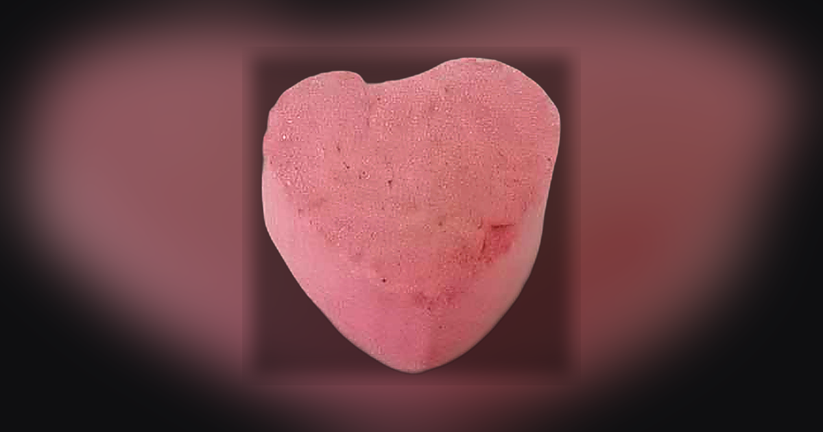 Heart