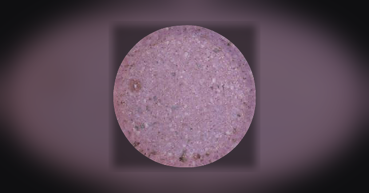 4-AcO-DMT; Psilocin