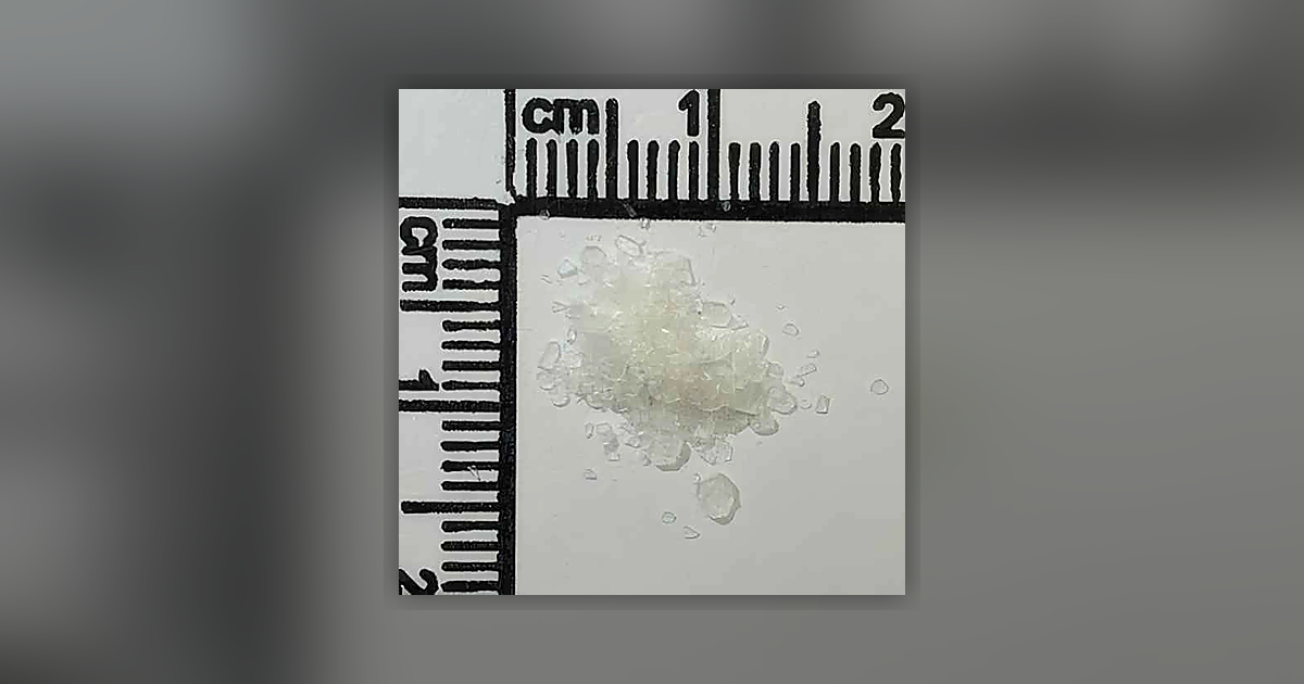 Procaine