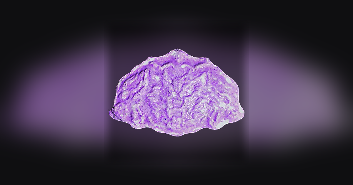 Shell pills (Ecstasy / MDMA)