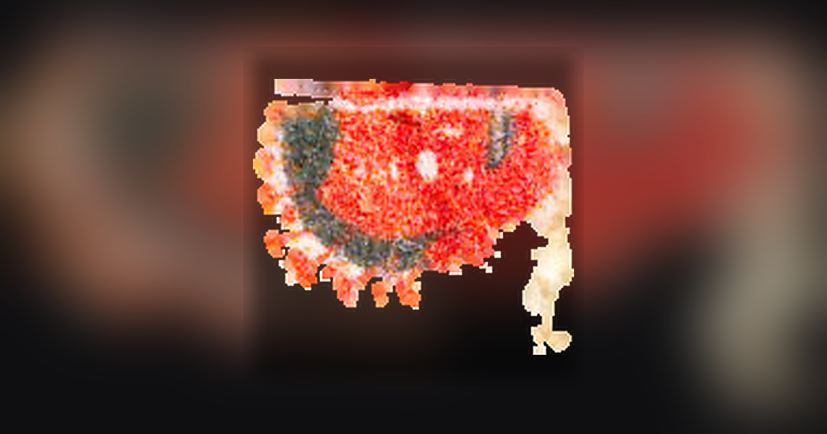 LSD (95µg)