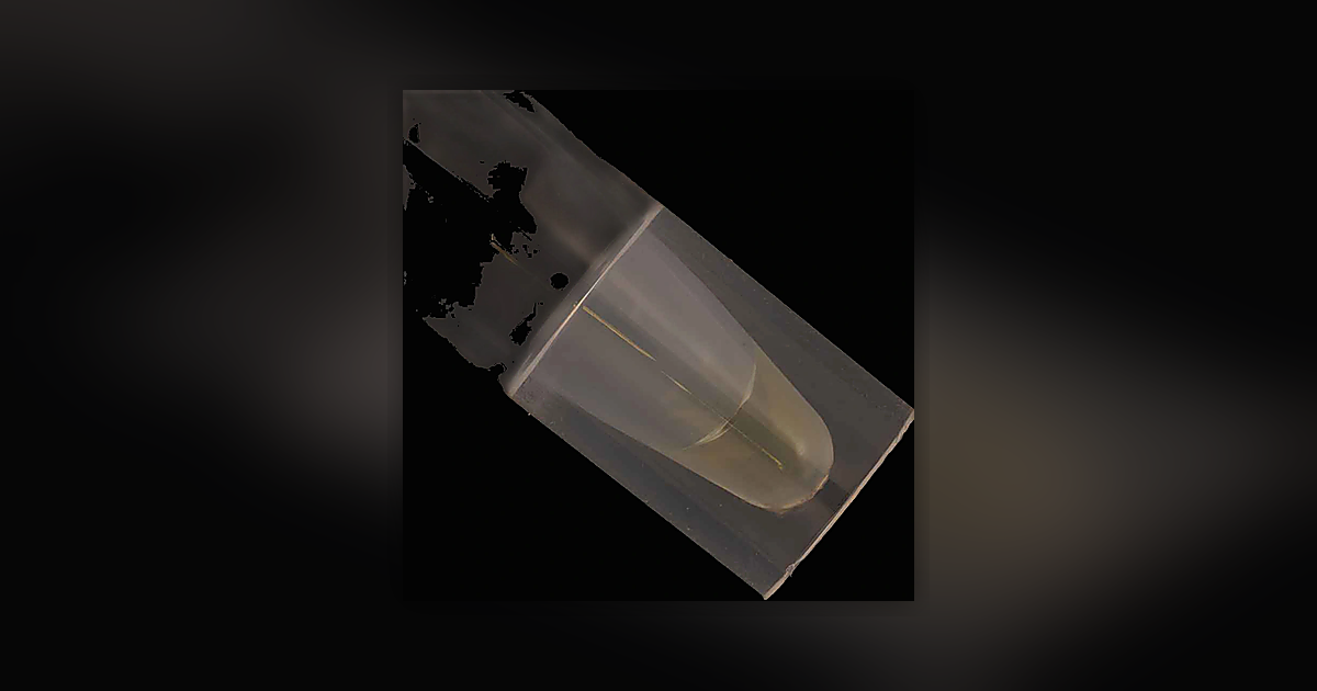 LSD