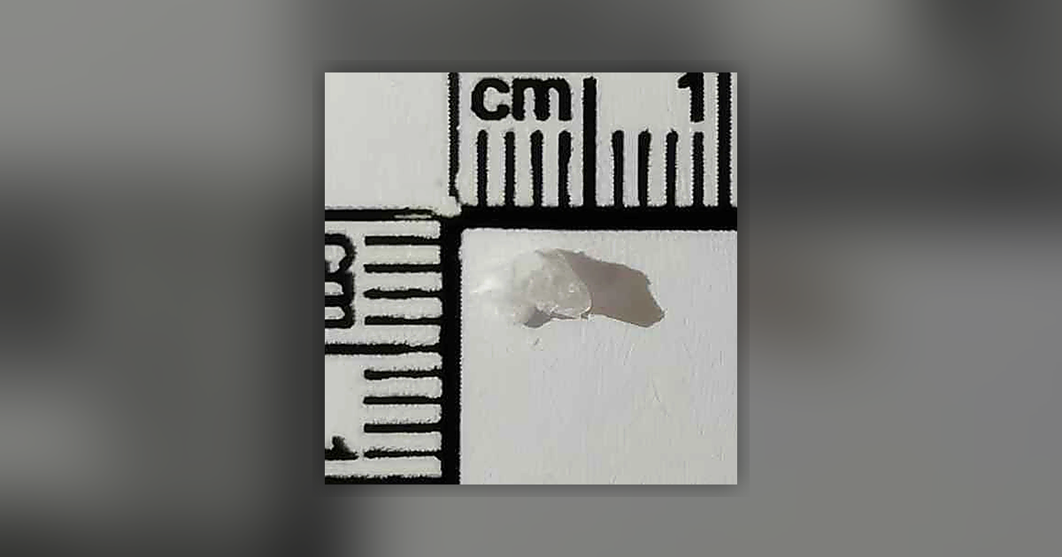 N-etilnorpentedron; MSM
