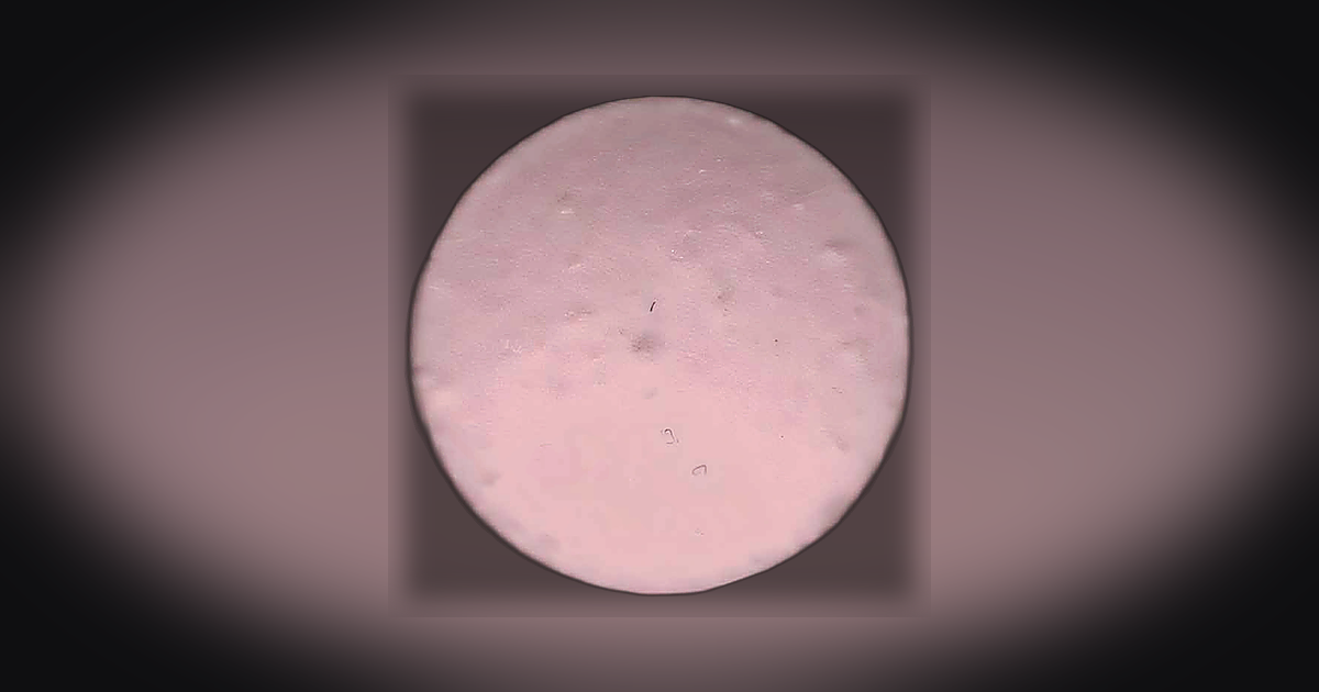 LL