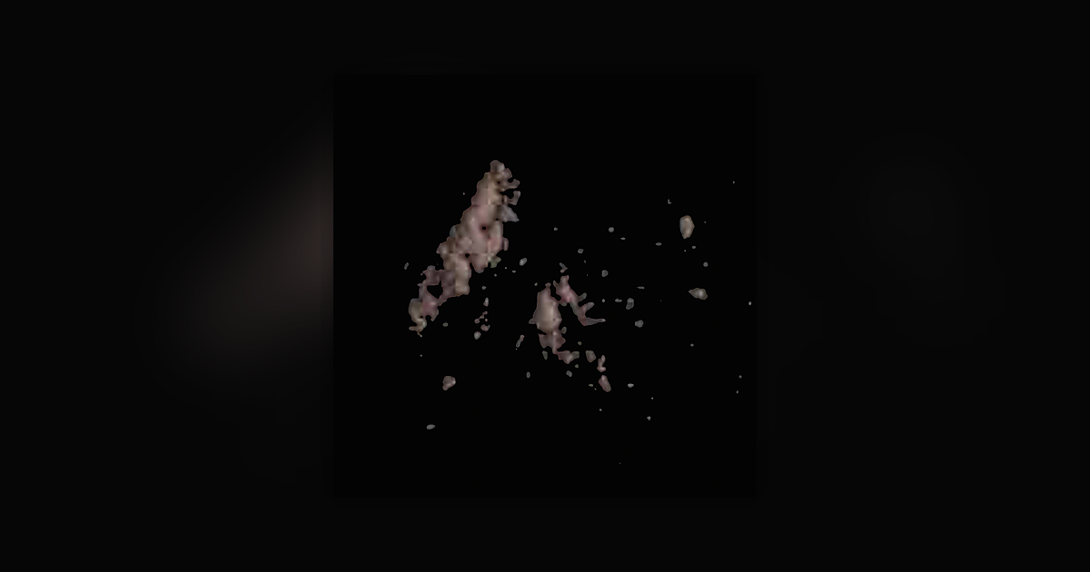 Ketamine