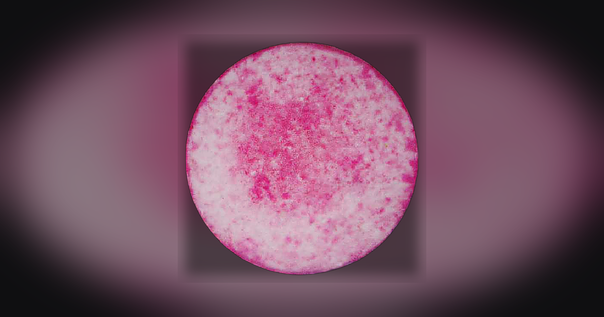 Oxazepam