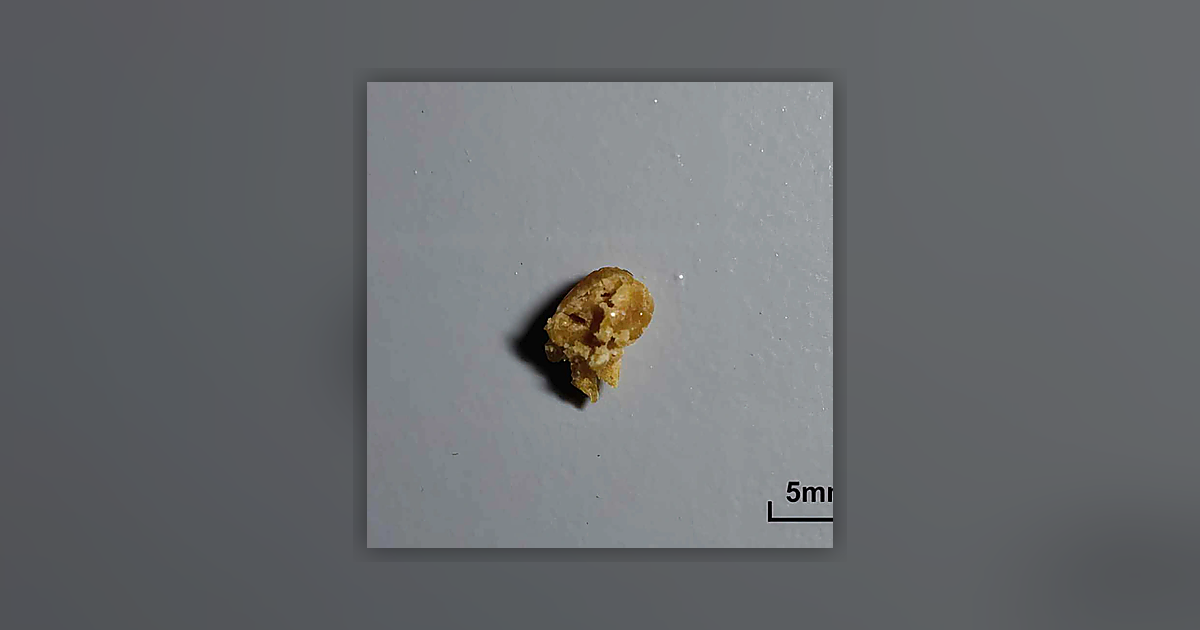 Heroin (27%); 6-MAM; Unknown