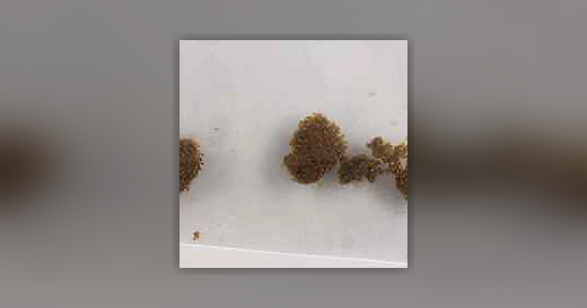 Delta-8-THC; THC; CBD