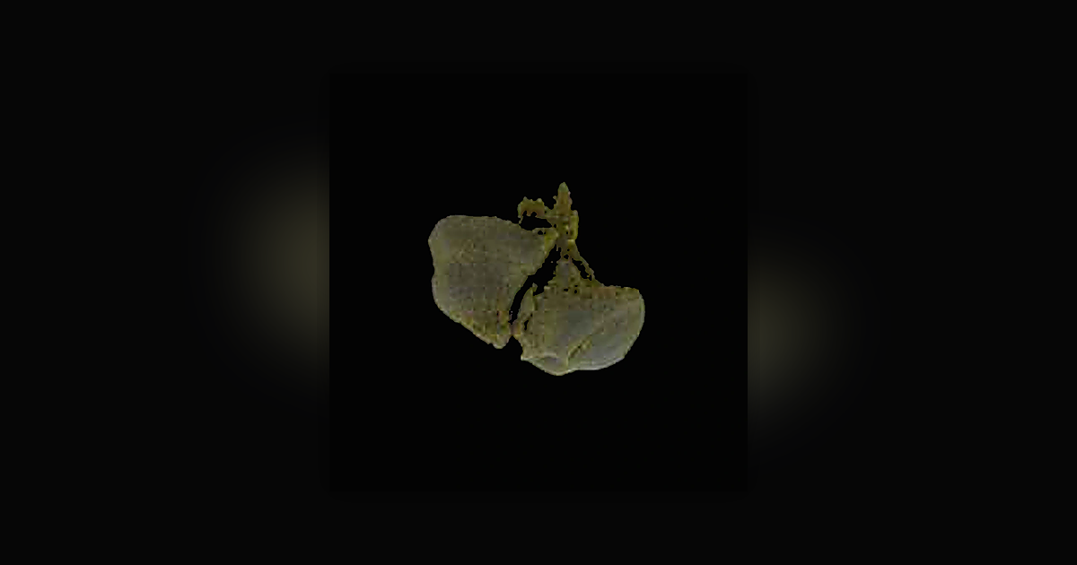 Delta-8-THC; THC; CBD