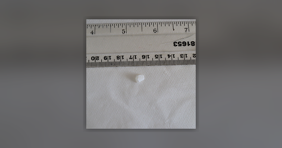 Cocaine; Benzoylecgonine; Ecgonine methyl ester