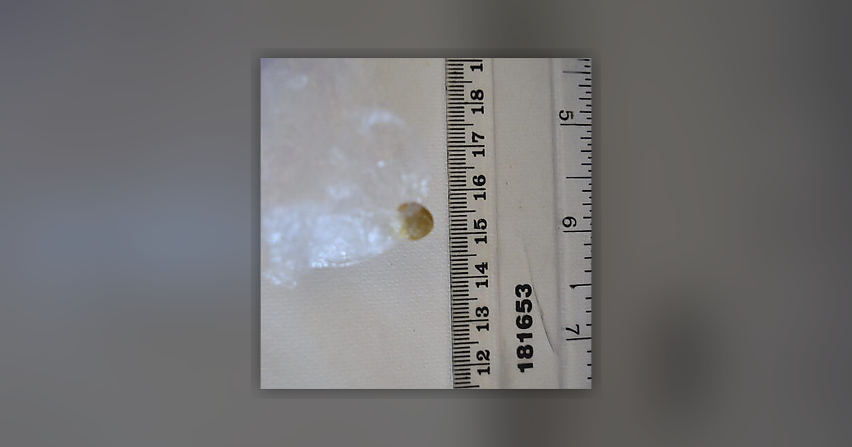 Toad Venon Albino Piatella