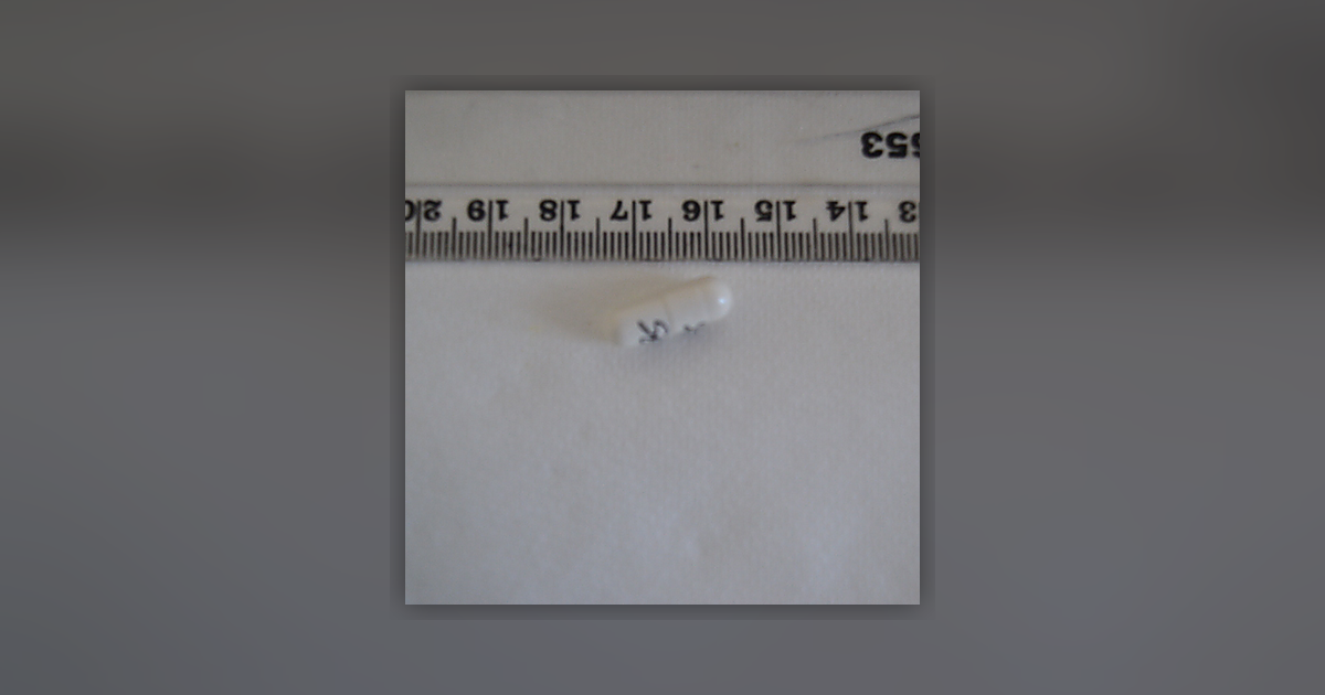 Pregabalin