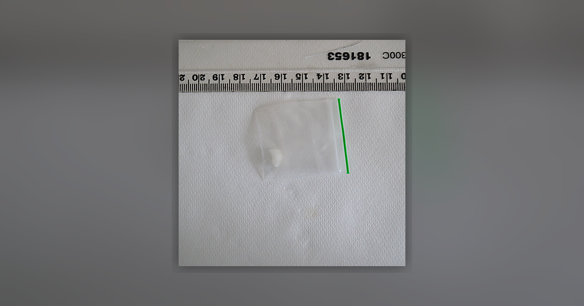 Cocaine; Benzoylecgonine; Ecgonine methyl ester