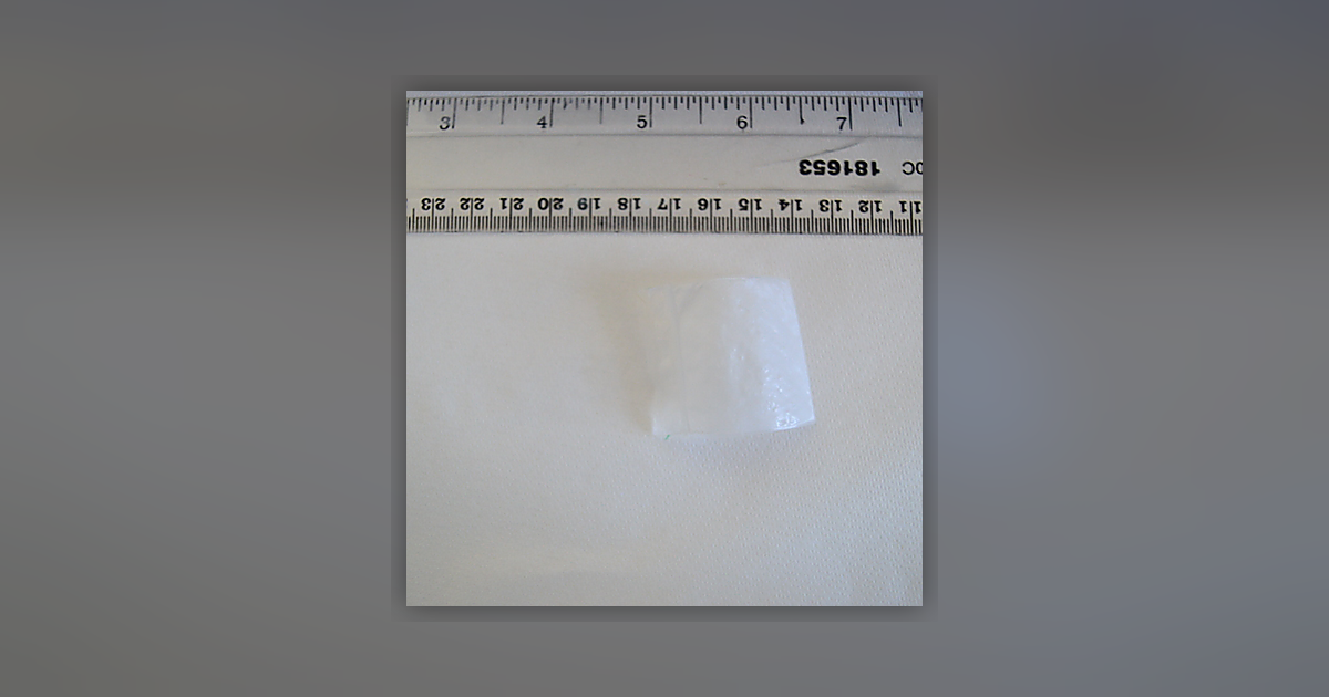 Ketamine