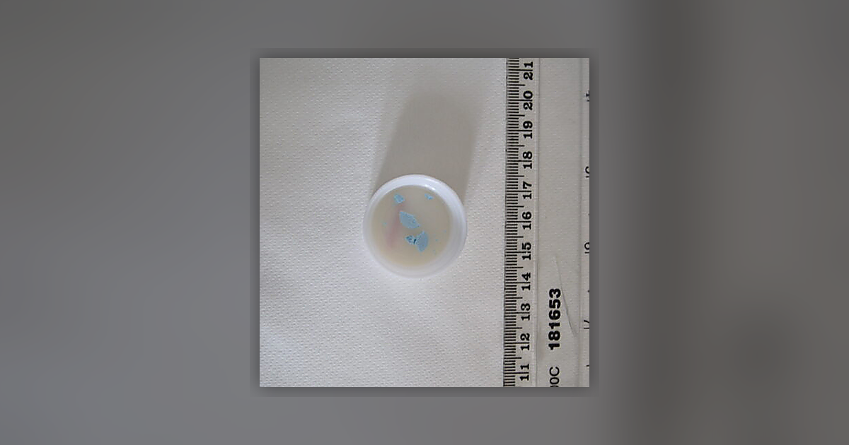 Diazepam Roche
