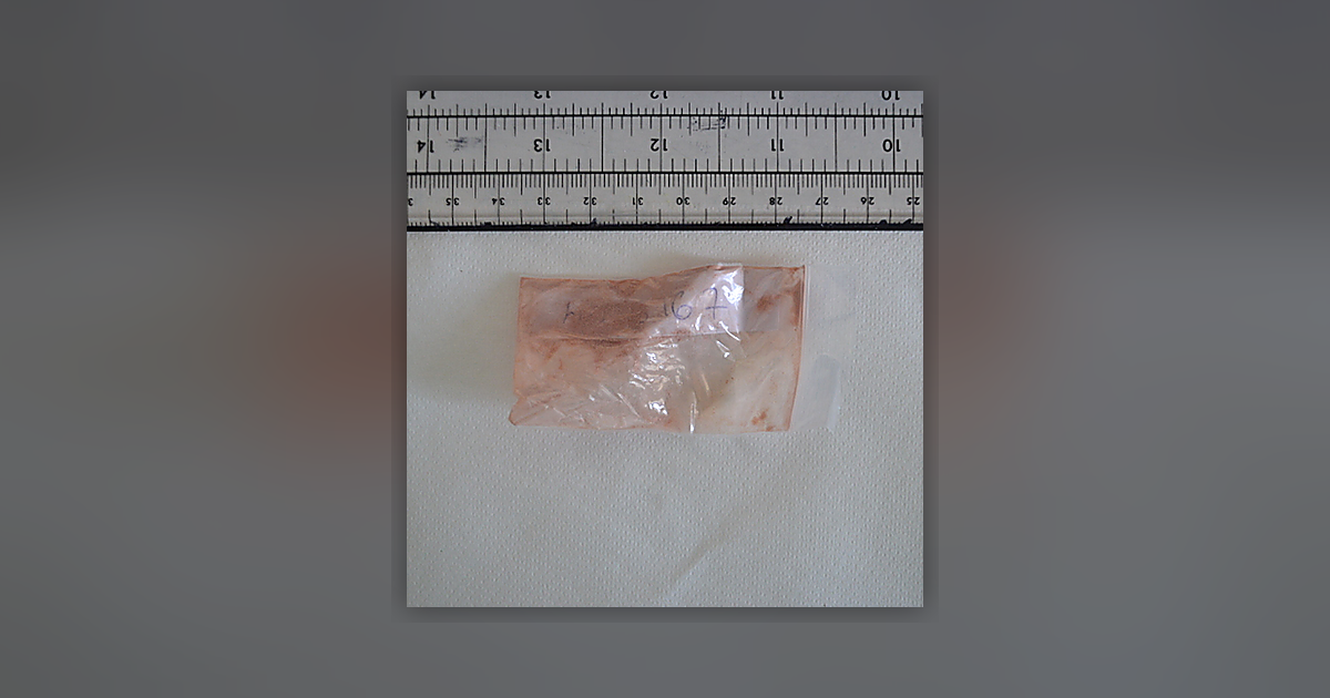 MDMA