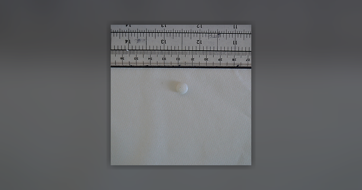 Diazepam