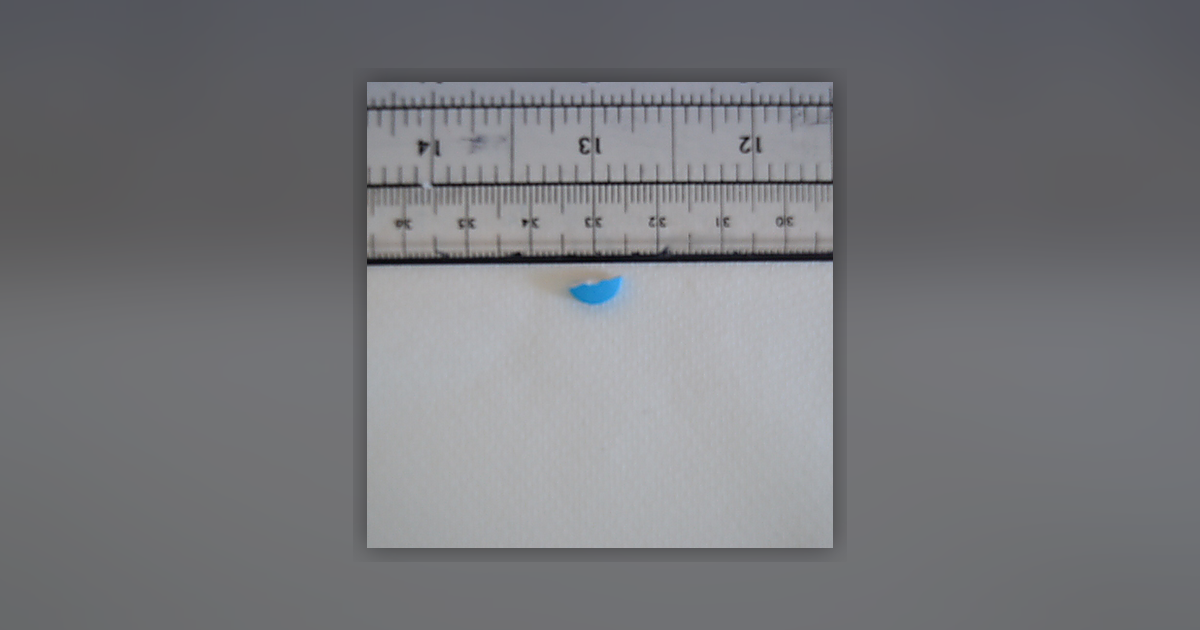 Zopiclone