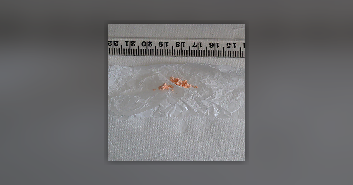 Pfizer Ativan Lorazepam