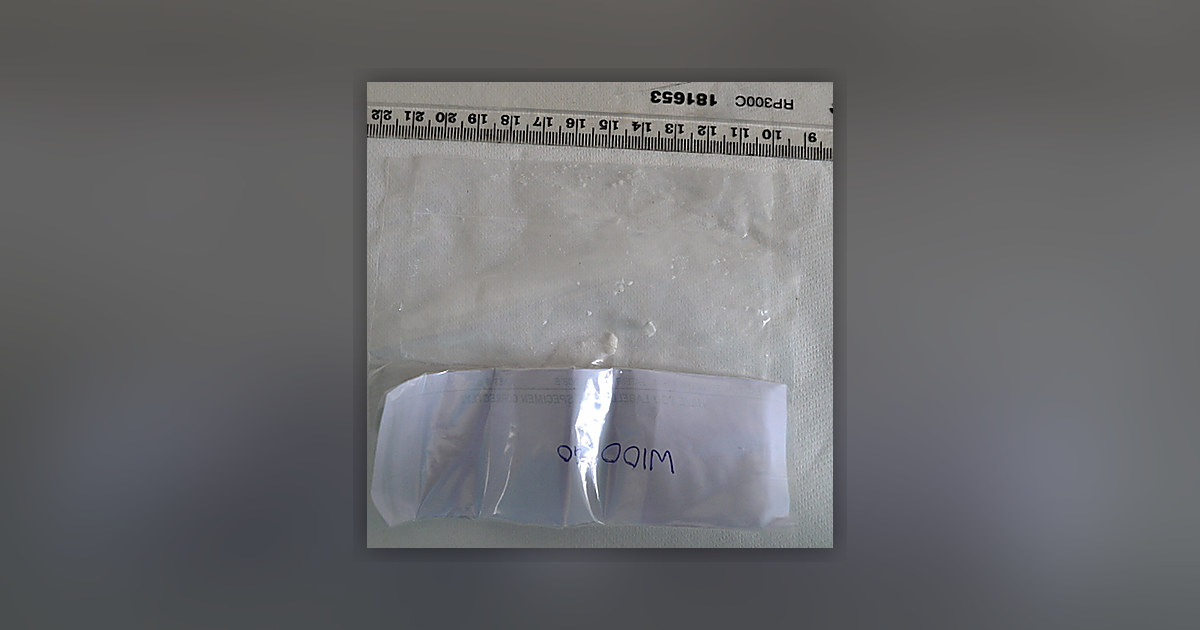 Cocaine; Benzoylecgonine