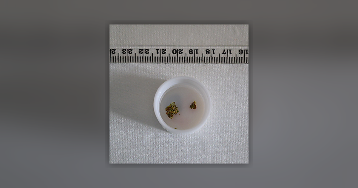 CBG; CBN; THC