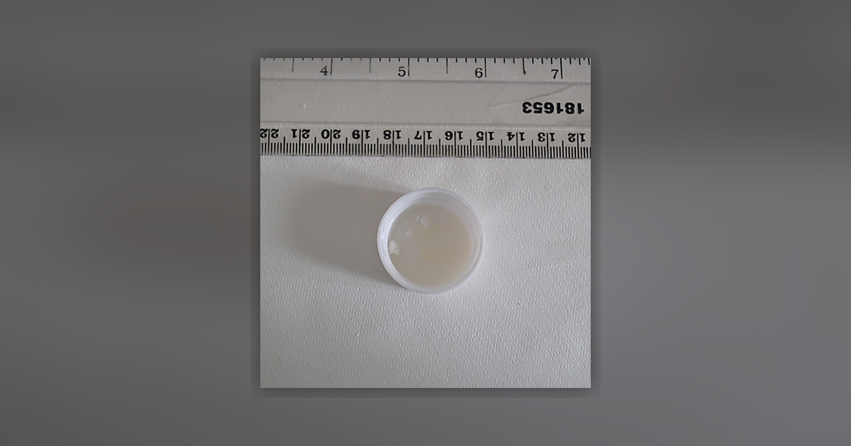 Cocaine; Phenacetin; Benzoylecgonine